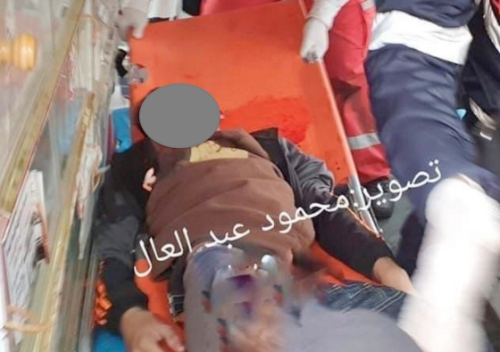 Adham Emara (17) direkt ins Gesicht geschossen verdeckt
